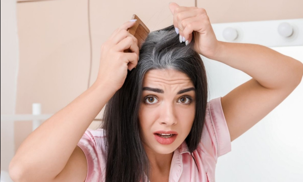 Ilustrasi uban tumbuh dini.(Foto: Shutterstock/Pixel-Shot)