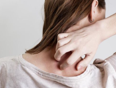 Ilustrasi. Rasa gatal yang muncul saat stres atau berada di bawah tekanan bukan sekadar sugesti, tetapi respons nyata tubuh terhadap kondisi psikologis. (Foto: iStockphoto/triocean)