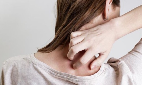 Ilustrasi. Rasa gatal yang muncul saat stres atau berada di bawah tekanan bukan sekadar sugesti, tetapi respons nyata tubuh terhadap kondisi psikologis. (Foto: iStockphoto/triocean)