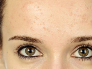 Ilustrasi. Ada beberapa alasan ilmiah yang bikin muka terlihat lebih tua. (Foto: iStockphoto/stock_colors)