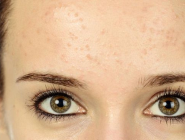Ilustrasi. Ada beberapa alasan ilmiah yang bikin muka terlihat lebih tua. (Foto: iStockphoto/stock_colors)