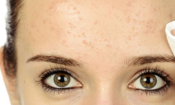 Ilustrasi. Ada beberapa alasan ilmiah yang bikin muka terlihat lebih tua. (Foto: iStockphoto/stock_colors)