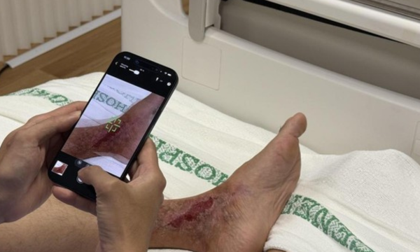 Cerita Dokter dan Perawat Pakai Gadget Apple untuk Rawat Pasien
(Foto: Virgina Maulita Putri/detikINET)
